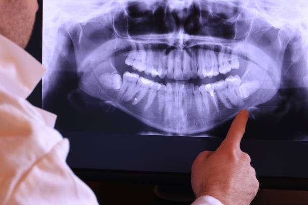 Best Emergency Tooth Extraction in Salisbury, MD