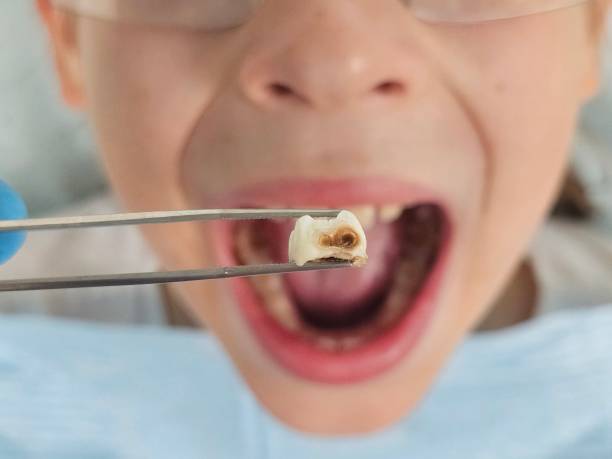 Best Emergency Denture Repair in Salisbury, MD